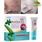 Acne Scar Gel